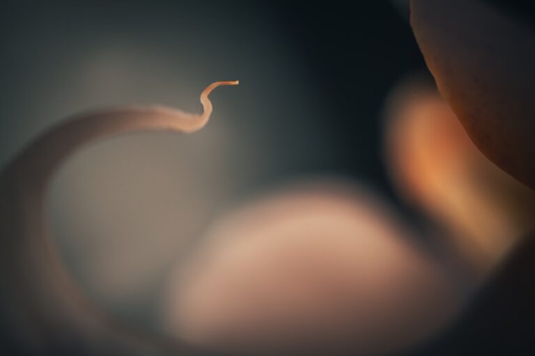 研究显示微重力影响精子导航能力