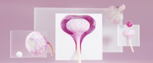 Amplia targets ovarian cancer in new clinical protein inhibitor trial