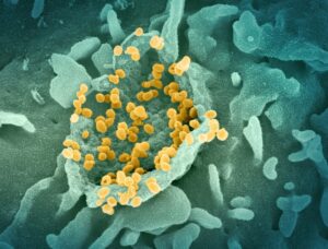 What is hantavirus, the suspected disease behind a deadly cruise ship outbreak?