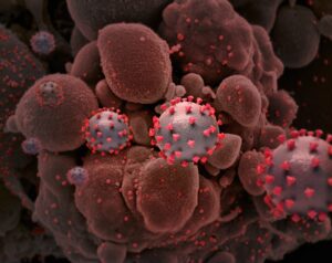 What is hantavirus, the suspected disease behind a deadly cruise ship outbreak?