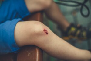 Young man severely injured after jumping from height into pool